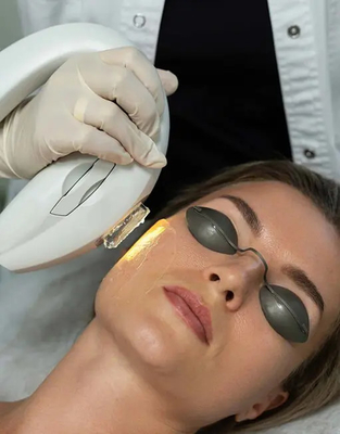 دستگاه لیزر موهای زائد 615 نانومتری OPT آکنه جوانسازی فوتون عروقی Ipl
